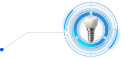 Implant Dentistry