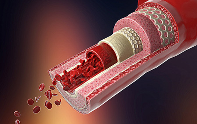 Exploring Methods to Enhance the Delivery Performance of Coronary Vascular Interventional Catheters
